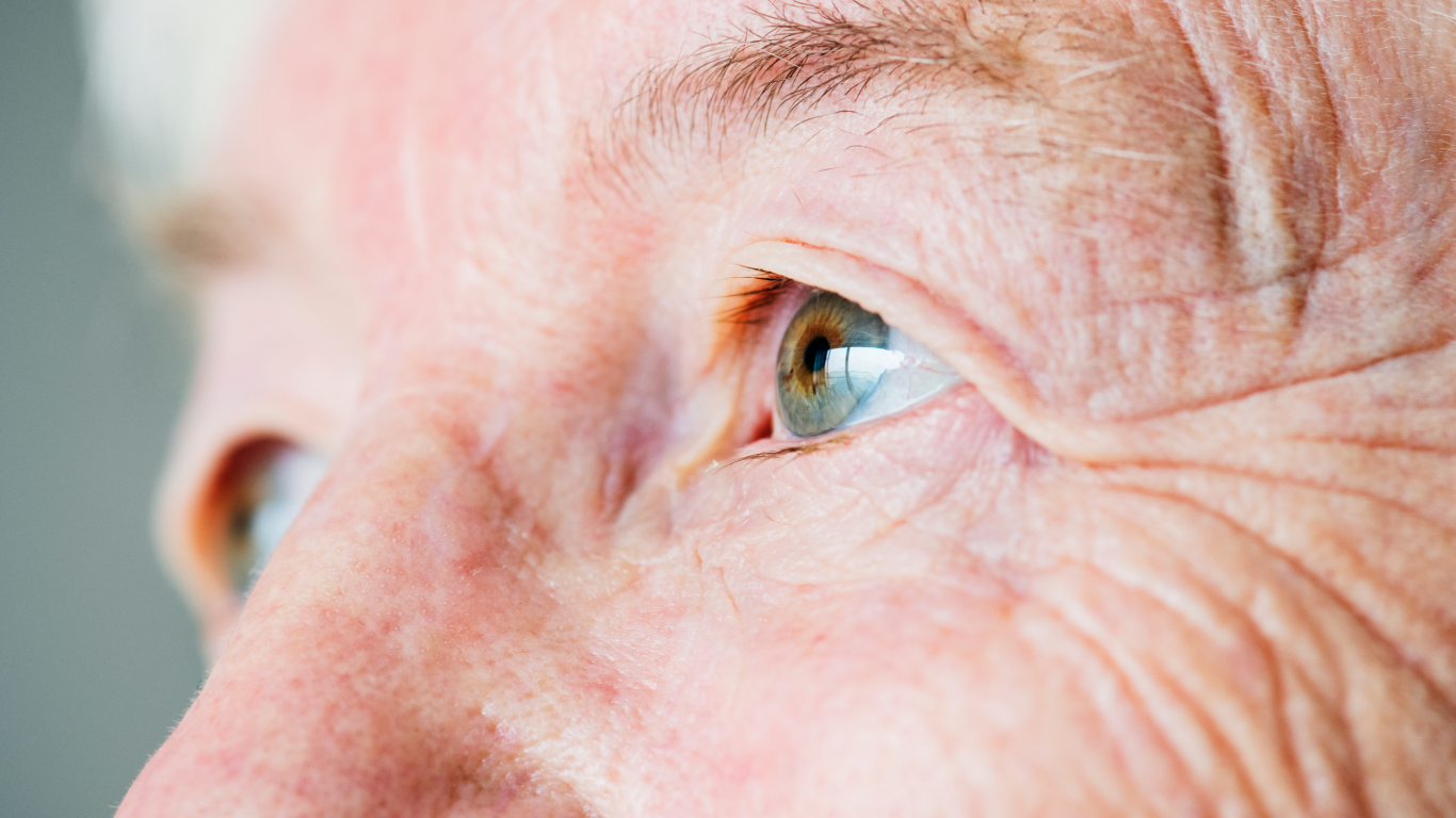 Foco nos olhos da mulher idosa, para falar sobre quando se recomenda a cirurgia de catarata