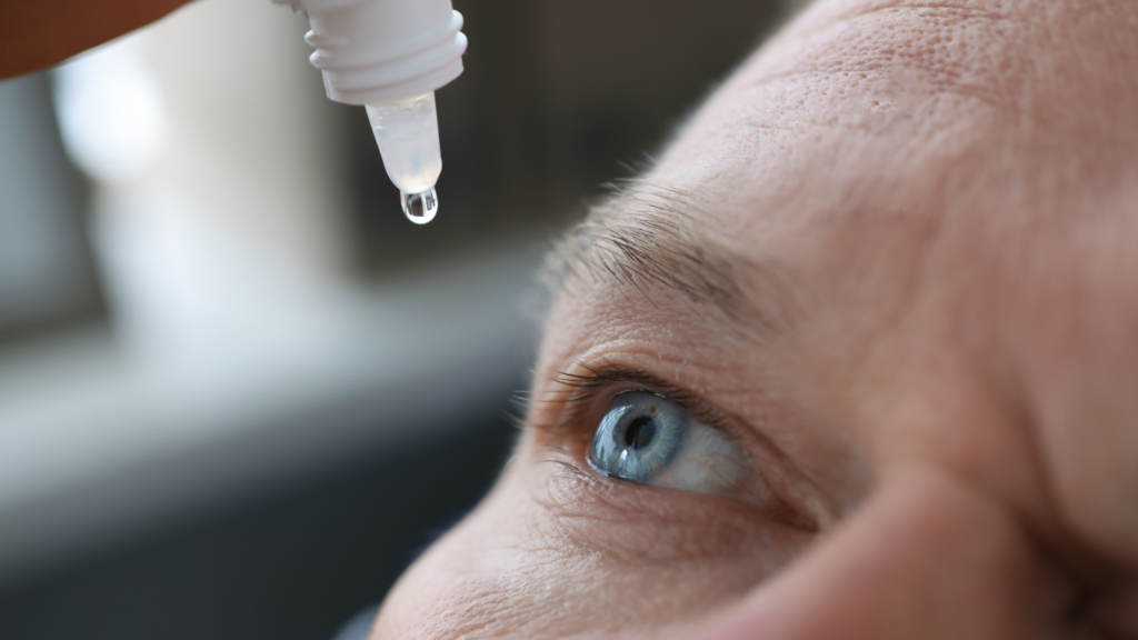 Homem pingando colírio no olho, para falar sobre tratar glaucoma