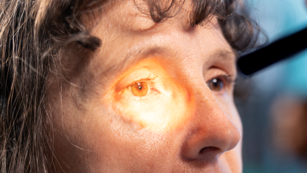 Médico exameinando olho da paciente, para falar sobre o que é o glaucoma