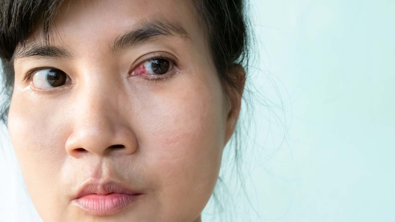 Mulher suspeitando de doenças oculares silenciosas